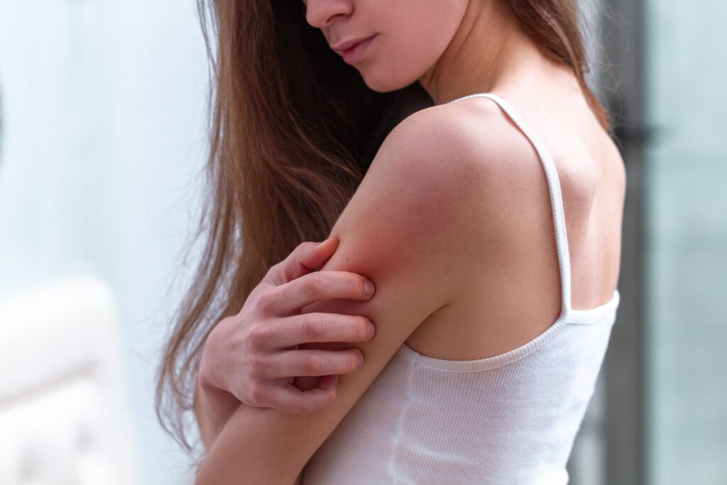 woman with itchy rash
